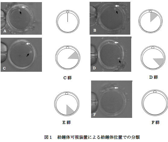 スピンドルビュー